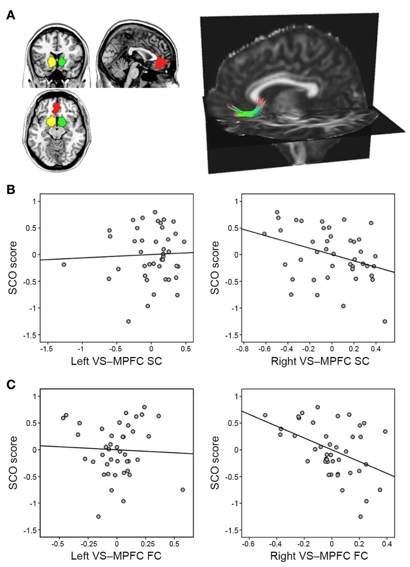 Ventral striatum and medial prefrontal cortex ROIs and white-matter tracts, and scatterplots showing weaker right VS-MPFC structural and functional connectivity predicting higher social comparison orientation