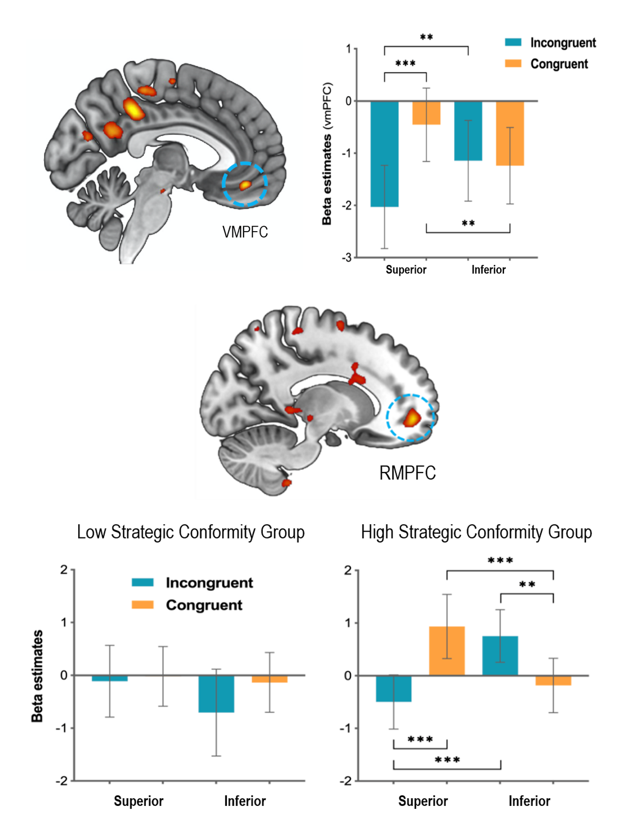vmPFC and rostral mPFC beta estimates showing distinct roles in conforming to a superior partner's preferences